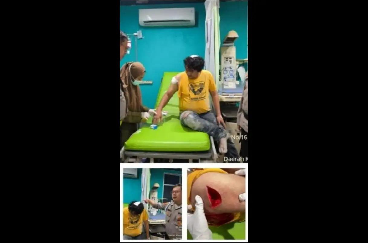 Dikeroyok Massa Saat Pengembangan Kasus Narkoba di Cilincing, Anggota Polsek Babelan Bekasi Alami Luka Sobek